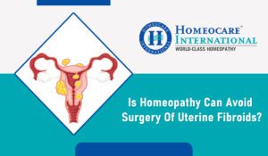 Read more about the article Is homeopathy can avoid surgery of Uterine Fibroids?