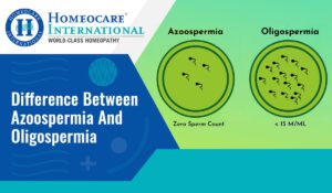 Read more about the article What is the difference between Azoospermia and Oligospermia?