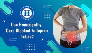 Read more about the article Can homeopathy cure blocked fallopian tubes?