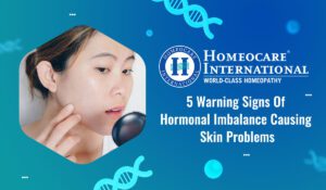 Read more about the article 5 warning signs of hormonal imbalance causing Skin Problems